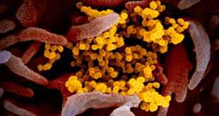 coronavirus and human cells